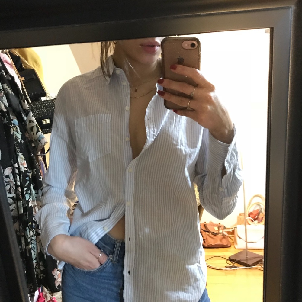 Button up